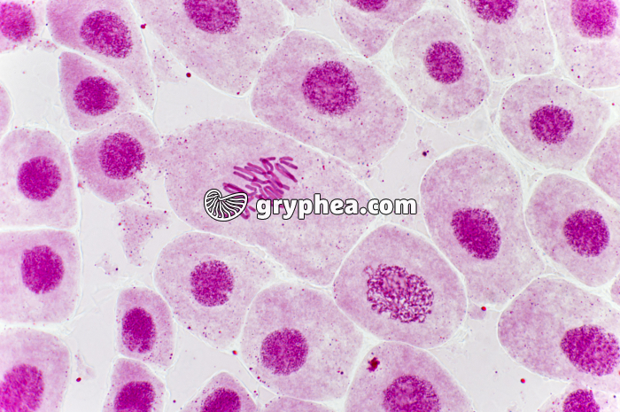 Mitose racine d'Ail (métaphase) coloration Carmin acétique x200 - gryphea.com